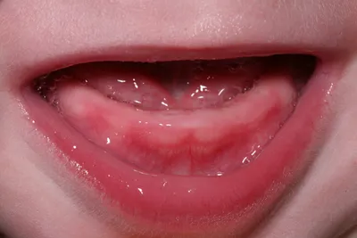 Когда прорезываются молочные зубы у детей?