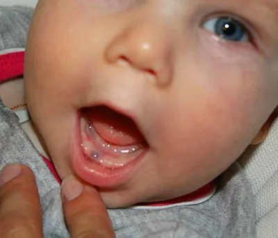 Сколько у детей должно быть в норме молочных зубов