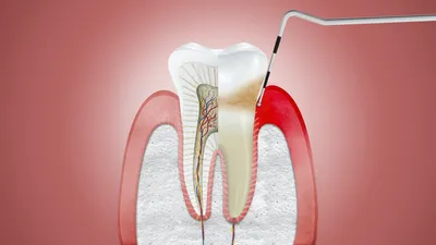 Гель для десен детский DENTINALE NATURA 20 мл купить в Минске — цены в  интернет-магазине 7745.by