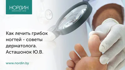 Воспаление ногтя – цены на лечение воспаления ногтя большого пальца на ноге  и руке в Москве | Клиника Полёт