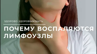 Схема оттока лимфы от головы и шеи. | ВКонтакте