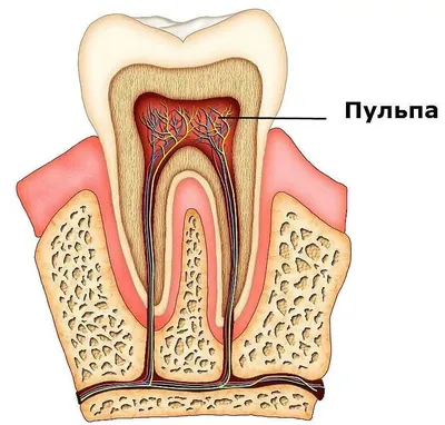Лечение пульпита одноканального зуба (без стоимости пломбы) - Дента-Эйд