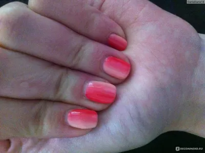 People Are Calling This Ant Manicure Animal Cruelty