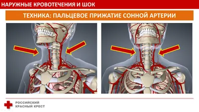 Жгут кровоостанавливающий