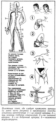 Кровотечение: практика