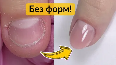 Наращивание Самых коротких ногтей 🎀 Длина 4см, острый миндал форма, 1.  Выполнены работы: Маникюр Наращивание Опил форму Выравнивание … | Instagram