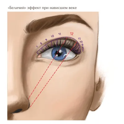 Эффекты наращивания ресниц – виды и схемы
