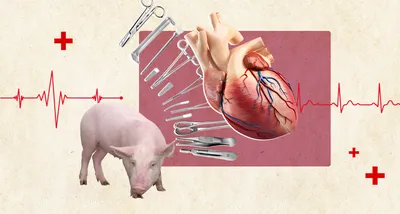 Свиное сердце. Смогут ли органы животных спасти человеческие жизни |  Новости Украины | LIGA.net