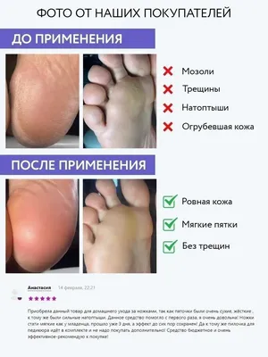 Крем для ног ARAVIA Professional для удаления мозолей и натоптышей Жидкий  педикюр Liquid Pedicure 150 мл купить по цене 592 ₽ в интернет-магазине  Детский мир