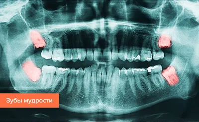 Прорезывание зубов у детей - Дентум Стоматология