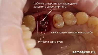 Название зубов и стетоскопа. Дизайн иллюстрации вектора декоративный  Иллюстрация вектора - иллюстрации насчитывающей зуб, стикеры: 190663037