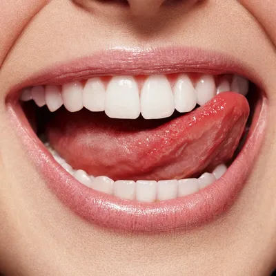 Слизистая полости рта — особенности и строение — Стоматология «Доктор  НеболитЪ»