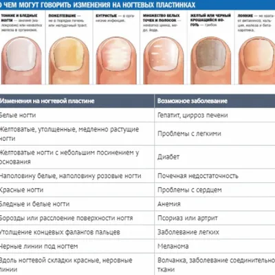 Пожелтение ногтевой пластины (51 фото)