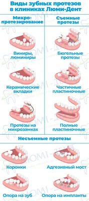 Протезирование зубов в Санкт-Петербурге (съемное и несъемное) по доступным  ценам