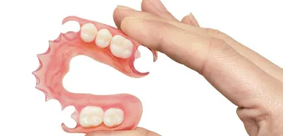 Зубной протез-бабочка [цена установки иммедиат-протеза на 1 зуб]