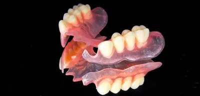 Нейлоновые гибкие съемные зубные протезы: плюсы и минусы, изготовление и  установка