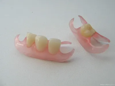 Съемные зубные протезы по низким ценам - Краснодар. Стоимость на частичное  и полное съемное протезирование