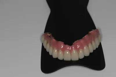 Нейлоновые протезы (зубные съемные) – цена, отзывы, фото