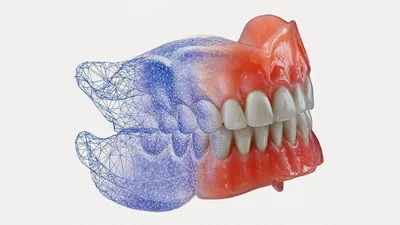 Нейлоновые зубные протезы - цена в Москве | Клиника МАЙ