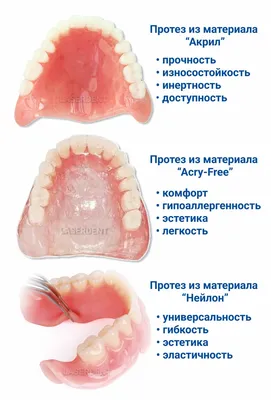 Съемные зубные протезы в Киеве 🦷 Цены на съемные протезы Дарница |  iStomatolog