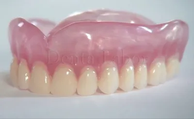 Съемный зубной протез на верхнюю челюсть купить в Denta-Labor | Полные  съемные протезы при полном отсутствии зубов на верхней челюсти цена