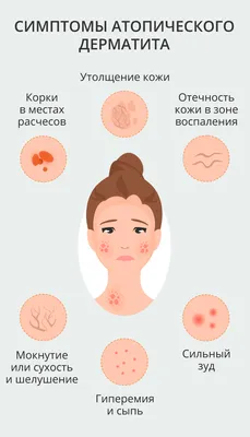 Нейродермит на лице: причины, симптомы (фото), лечение