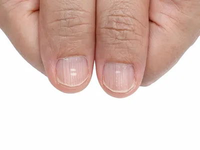 Витамины для ногтей: свойства, польза – какие витамины нужны для улучшения  ногтей