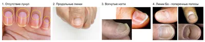 rita_nail_126 - Нехватка витаминов в организме сильно сказывается на коже  рук и ногтевой пластине. Поэтому так важно держать их уровень в норме. 1. Витамин А (ретинол, бета-каротин). Участвует в формировании и росте ногтевой