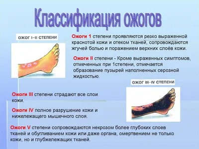 Лечение пролежней и опрелостей — Про Паллиатив