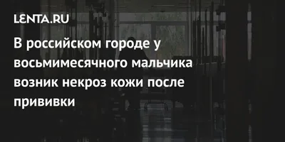 Лечение мультифакторной фиброзной дегенерации кожи и подкожной  соединительной ткани с применением биоимплантата «Сферо®Гель»