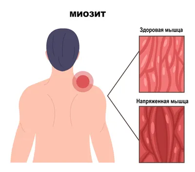 Ритидэктомия - пластическая операция по подтяжке лица