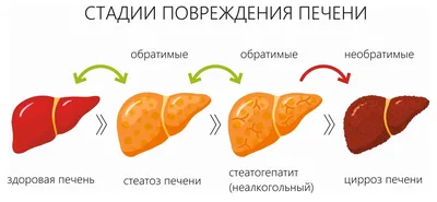 Как определить некроз головки бедра? ortoped-klinik.com