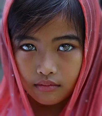 Глаз этой девушки выглядит странно по одной необычной причине | Пикабу