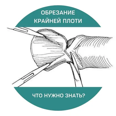 Обряд \"обрезание\" проводят в Нур-Султане бесплатно | Inbusiness.kz