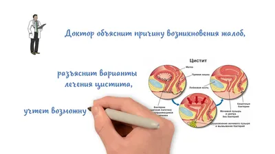 Лазерное обрезание крайней плоти - AXEL Clinic