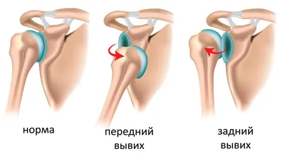 Блокированная пластина для лучевой кости (дистальная  диафизарная),Производители медицинского оборудования - Double Medical