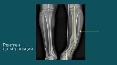 Блог клиники современной ортопедии и травматологии Ladisten