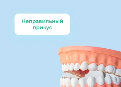 Исправление прикуса в клинике Dentserv: эффективность, профессионализм,  доступные цены