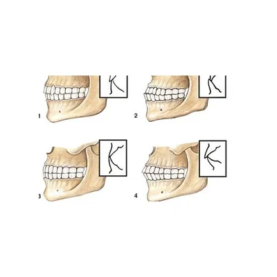 Сеть клиник МЕГИ - Как определить правильный или неправильный прикус? ⠀  Представьте буквально на 5 минут, что вы врач и сами себе диагностируете  прикус. 😅 Иногда таким можно заниматься, но только по