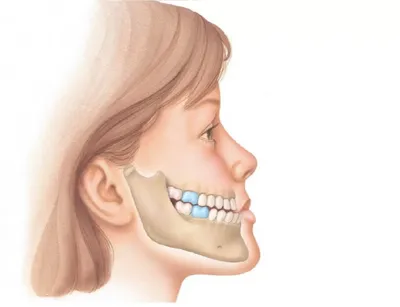 Неправильный прикус | Стоматология \"Ультра-Дент\" | Дзен