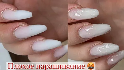 🤮Закисшие ТВОРОЖНЫЕ НОГТИ😨ЗЕЛЕНЬ и Пустота под Ногтями.НЕУДАЧНОЕ  Наращивание.УКРЕПЛЕНИЕ ЛЮБЫХ НОГТЕЙ - YouTube