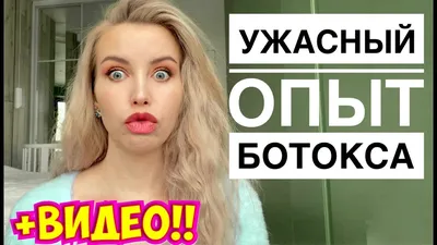 15 знаменитостей, доигравшихся с ботоксом » BigPicture.ru