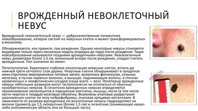 Проверить родинки и другие новообразования. На Южном Урале проходит акция  «Онкопатруль» - YouTube