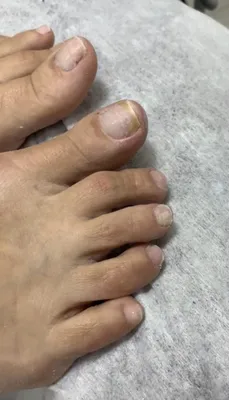 Педикюр | Unghie dei piedi nere, Unghie corte gel, Capelli e unghie