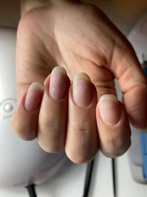 Ногти женщин без маникюра стоковое фото. изображение насчитывающей ногти -  183075262