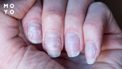 До и после коррекции наращенных ногтей: советы профессионалов | AMALFI  BEAUTY | Дзен