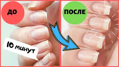 IBX System лечебное покрытие - сделать ногти в Москве - салоны красоты  «100ЛИЦА»