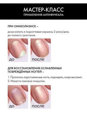 Руки женщины до и после процедуры коррекции маникюра Стоковое Фото -  изображение насчитывающей после, шикарно: 209748110