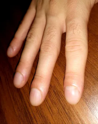О чем расскажут ваши ногти: состояние ногтей и что с ними может быть не так  / Оффтопик / iXBT Live