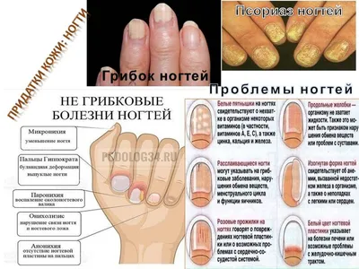 Ониходистрофия: причины, методы лечения у взрослых и детей, цена в Москве